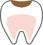 C1
