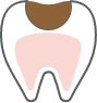 C2