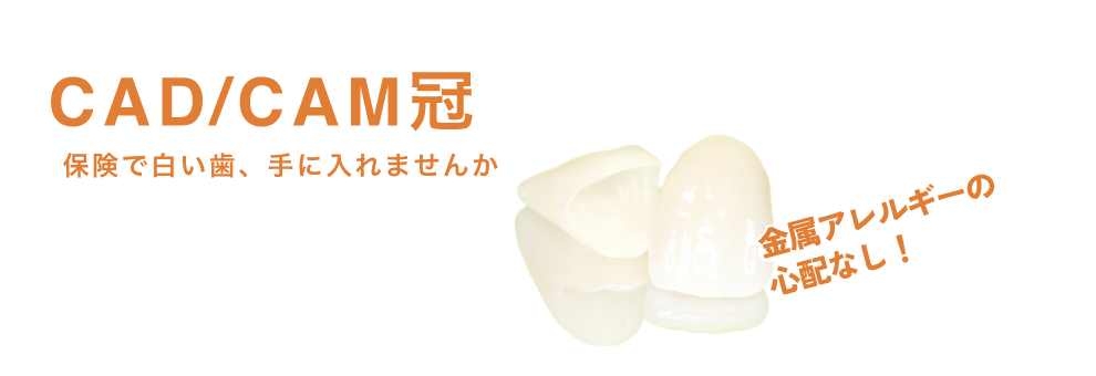 保険で白い歯、手に入れませんか　CAD/CAM冠　金属アレルギーの心配なし！