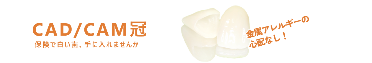 保険で白い歯、手に入れませんか　CAD/CAM冠　金属アレルギーの心配なし！